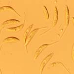 microscopic view of fungus Ephelis oryzae